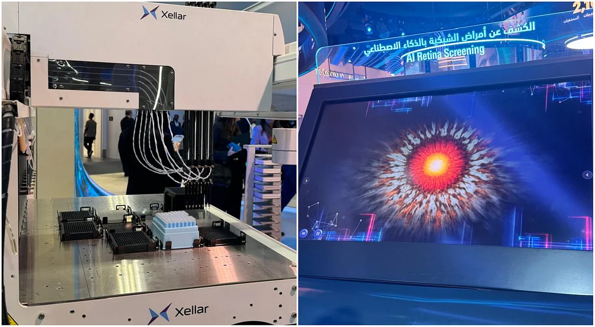 Organ in a chip, AI retina scanner: 5 health tech making UAE residents' lives easier