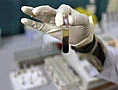 Now, a chip that detects disease in blood drop | Khaleej Times
