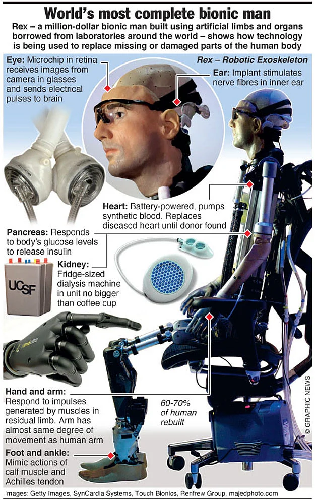 World’s most complete bionic man | Khaleej Times