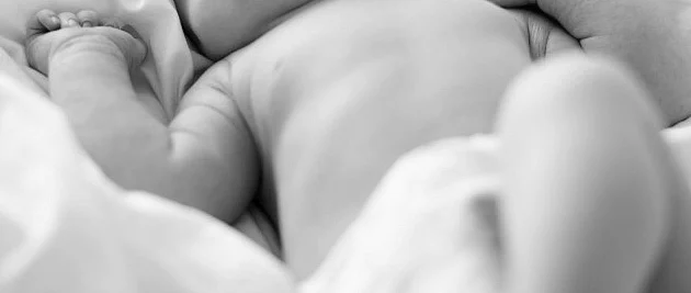 'Headless' baby born in Zimbabwe | Khaleej Times