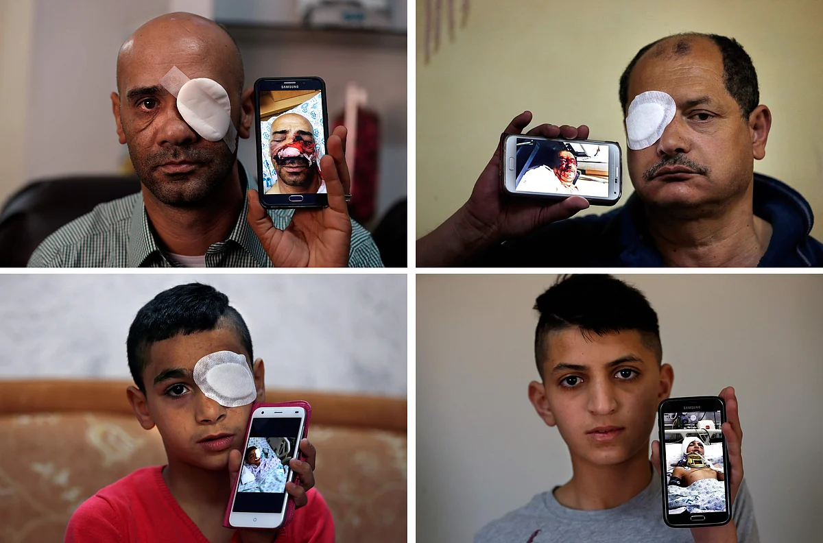 Israeli sponge bullets leave painful legacy for Palestinians | Khaleej ...