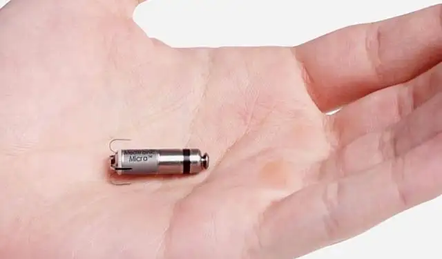 Micropace Pacemaker Micropacemaker to treat foetus with heart block | Khaleej Times