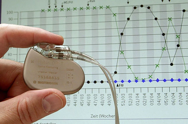A safe, reliable wireless pacemaker to hit stores soon | Khaleej Times